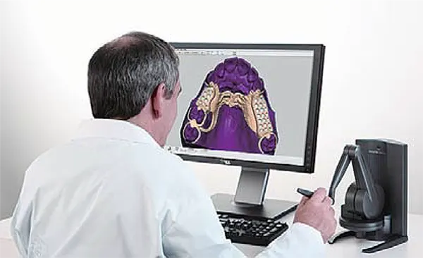 歯科補綴物設計支援 3D モデリングシステム Dental Lab System ＜デンタル・ラボ・システム＞